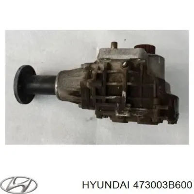 Раздатка (коробка раздаточная) HYUNDAI 473003B600